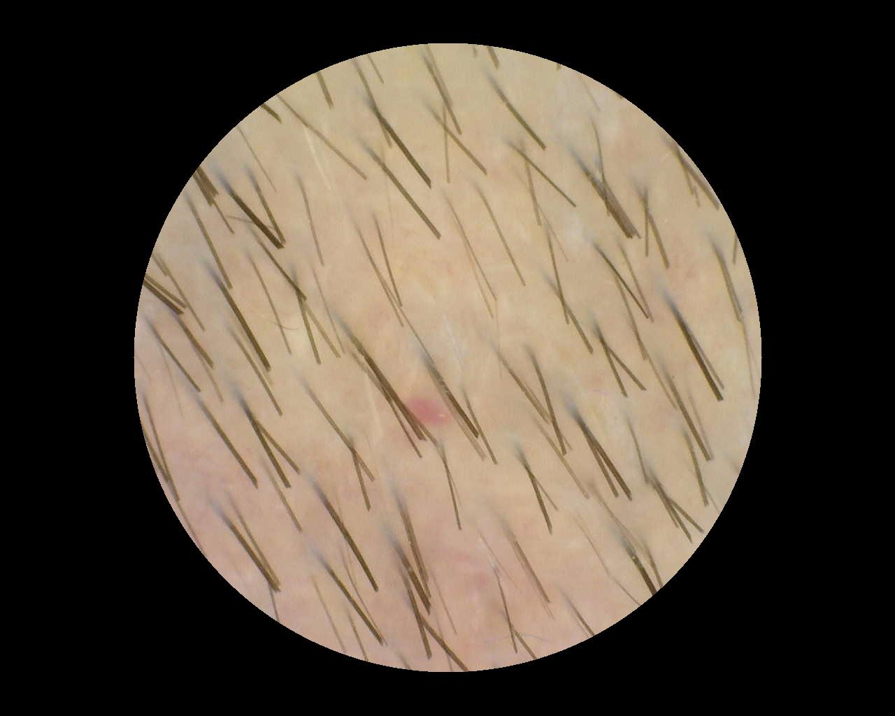 Sample image 4 for TrichoScan analysis, captured with Dino-Lite