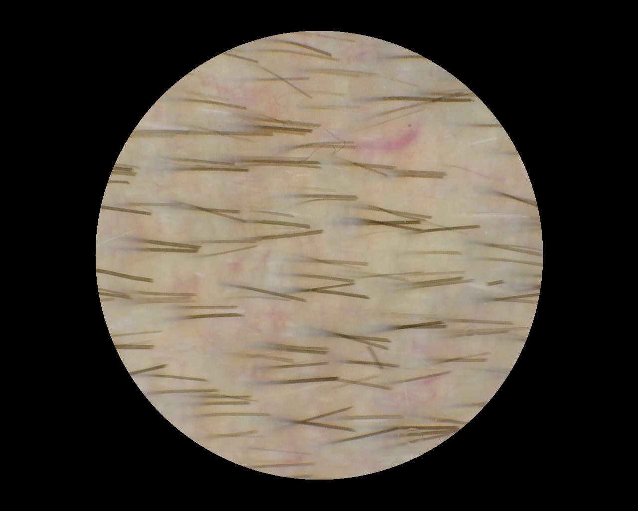 Sample image 5 for TrichoScan analysis, captured with Dino-Lite