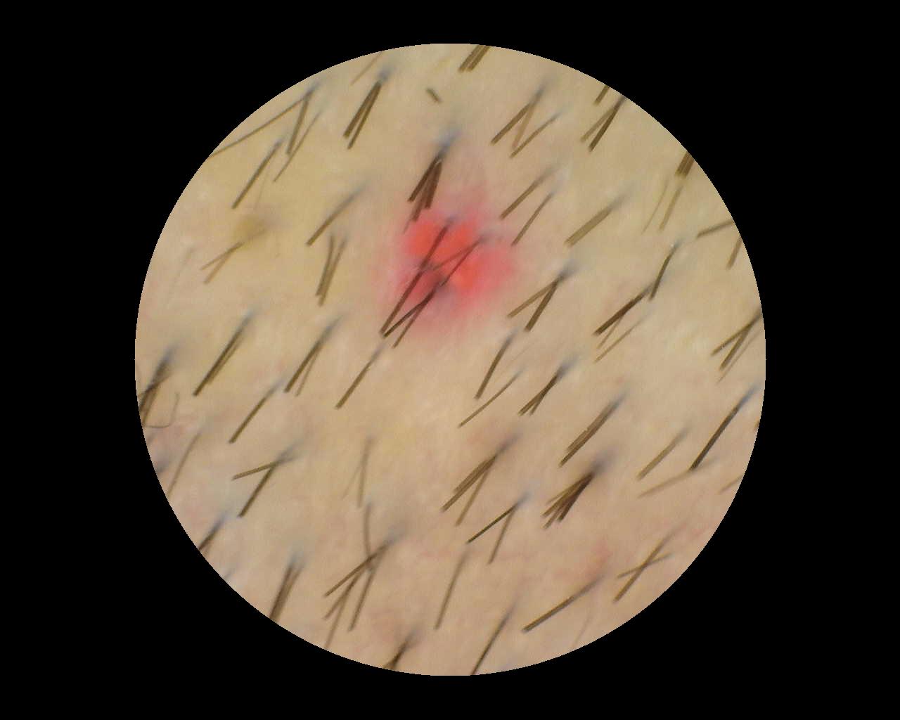 Sample image 6 for TrichoScan analysis, captured with Dino-Lite