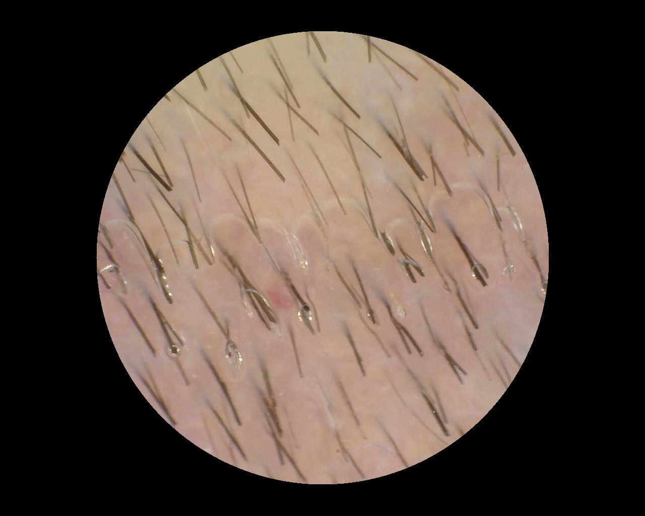 Unsuitable sample image: air inclusions and blurred image area