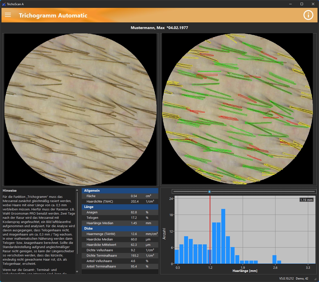 TrichoScan Screenshot 3